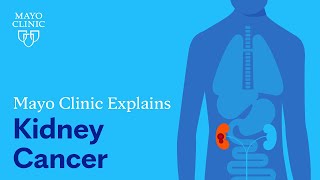 Mayo Clinic Explains Kidney Cancer [upl. by Jenn846]