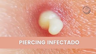 Piercing Infectado ¿Cómo saber si mi perforación esta infectada [upl. by Animsay]