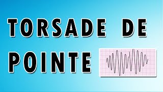 Torsade de Pointes [upl. by Eceinart]