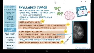 Benign breast conditions  pathology review  Osmosis [upl. by Ahsilak]