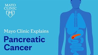 Mayo Clinic Explains Pancreatic Cancer [upl. by Epifano]