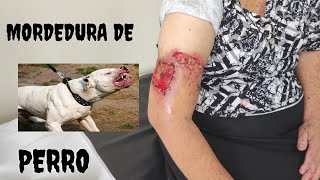 MORDEDURA DE PERRO [upl. by Nashoma527]