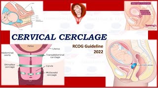 What is cervical cerclage  why cervical cerclage is important by Doctor Zainab Malik [upl. by Elatia]