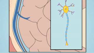 Understanding Diffuse Axonal Injury [upl. by Eelyram708]