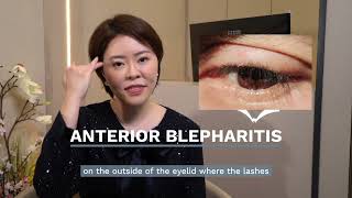 Do I Need To See A Doctor For A Swollen Eyelid  Dr Stephanie Young [upl. by Keel552]