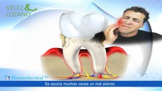 ¿Cómo tratar la periodontitis  Dentistas Murcia [upl. by Joao]