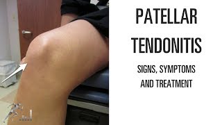 Patellar tendonitis Signs symptoms and remedies for this difficult knee problem [upl. by Royal]