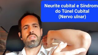 5 Dicas Tratamento da Neurite Cubital  Nervo Ulnar [upl. by Endaira]