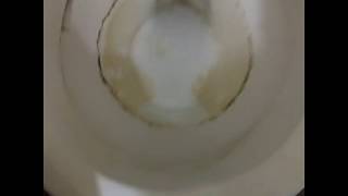 Toilet cleaning with baking soda and vinegar [upl. by Neysa294]