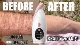 IPL Hair Removal My 8 Week Experiment amp Results [upl. by Wiebmer]