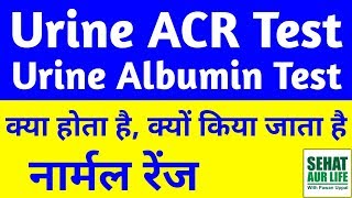 Urine ACR Test in Hindi Urine Albumin Test In Hindi Urine Albumin Normal Range [upl. by Stent]