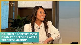 Dr Pimple Popper’s Most Dramatic Before amp After Transformations [upl. by Andy]