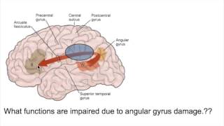 PROSOPAGNOSIA Face blindnessANGULAR GYRUS LESIONS [upl. by Aicelet]