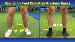 VERY EFFECTIVE Way to FIX Pronated feet amp Knees Caving In Valgus Knees [upl. by Fem]