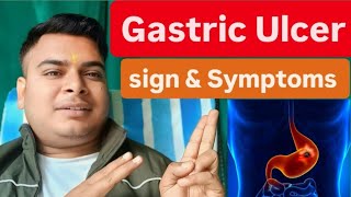 Gastric Ulcer in hindi  Ulcer sign and symptoms and treatment [upl. by Ellednahs]