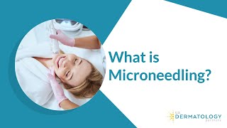 What is Microneedling  Microneedling Treatment [upl. by Eyot]