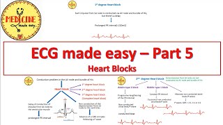 ECG made easyPart 5Heart blocks [upl. by Pandora]