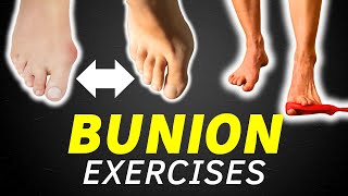 Bunion Exercises  Best Natural Treatment for Bunions  Hallux Valgus Exercises [upl. by Stricklan858]