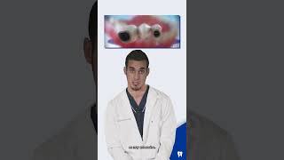 ¿Cuándo es necesaria una ENDODONCIA  Shorts [upl. by Kowatch]