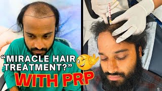 PRP to Boost Your Hair Growth Naturally and Bring Back Confidence [upl. by Aleta]