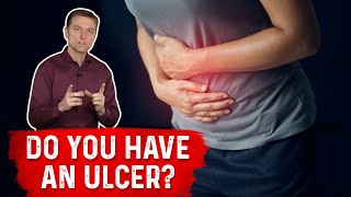 Understanding Ulcers How Do You Know If You Have One – Dr Berg [upl. by Wall]