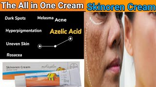 Skinoren Cream Review  Azelic acid Cream  Skinoren Cream How to Use  Benefits  Price [upl. by Namron]