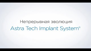 Astra Tech Implant System EV теперь в России [upl. by Medrek]