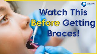 What To Know Before Getting Braces  8 Tips To Prepare You For Braces [upl. by Nicol]