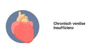 Chronisch venöse Insuffizienz CVI  Erkrankungen der Gefäße und des Kreislauf [upl. by Winchell]