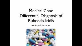 Medical Zone  Differential Diagnosis of Rubeosis Iridis [upl. by Fay437]