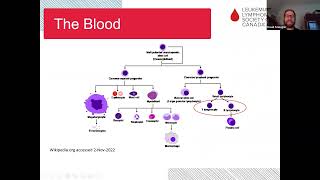 Acute lymphoblastic leukemia ALL Treatment options managing side effects and research advances [upl. by Einaeg]