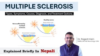 Understanding Multiple Sclerosis Symptoms Causes and Treatment Options  Dr Ragesh Karn [upl. by Pardo]