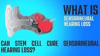 What is Sensorineural Hearing Loss How can it be treated [upl. by Atiugram509]