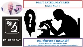 DAILY PATHOLOGY CASES CASE NO 13 BY Dr WAFAEY BADAWY [upl. by Ennaeus]