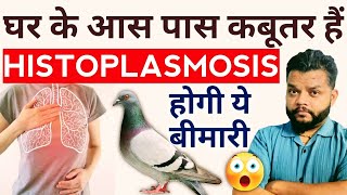 Histoplasmosis Causes Symptoms amp Treatment In Hindi  Histoplasma Capsulatum [upl. by Yelir]