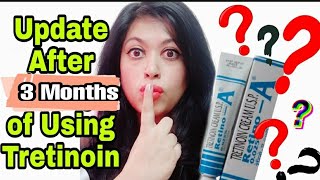 हिंदी TRETINOIN Cream Review 3 month Retin a UPDATE  Before amp AfterRetin A cream  Blush Blush [upl. by Atiraj]