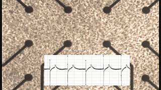 Beating Cardiomyocytes [upl. by Alaecim]