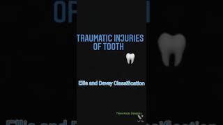 Fracture tooth Traumatic injuries of tooth  Ellis and Davey Classification [upl. by Elysee]