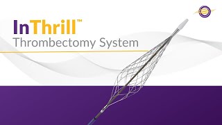 InThrill Thrombectomy System [upl. by Fritzie]