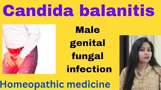 Candida balanitis treatment  Male genital fungal infection symptomscauses amp Homeopathic medicine [upl. by Yellhsa]