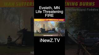 Rural Eveleth MN Man Suffers Life Threatening Burns [upl. by Attenwahs]