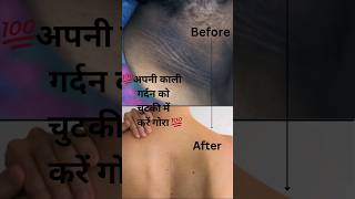 Neck blackness Remove at Home  kaali gardan ko kren Gora MemoonaMuslimaBeauty9 [upl. by Ludwog]