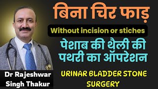 ENDOSCOPIC URINARY BLADDER STONE SURGERY बिना चीर फाड़ के पेशाब की थैली की पथरी का ऑपरेशन [upl. by Dnalel103]