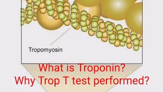 What is Trop T test  Trop T test procedure [upl. by Lowndes963]