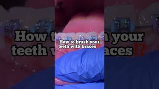 How to brush your teeth with braces  Tooth Time Family Dentistry New Braunfels [upl. by Feenah]