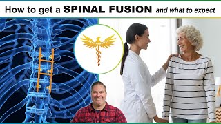 Spine surgeon explains What to Expect with spine fusion low back pain spondylolisthesis stenosis [upl. by Bibeau985]