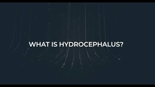 About Hydrocephalus [upl. by Phillida]