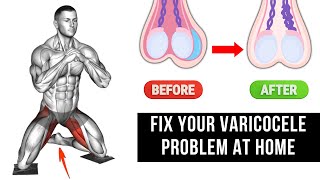 Top 6 Effective Exercises for Varicocele Treatment at Home [upl. by Giamo]