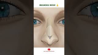 BULBOUS NOSE 👃  Cosmetic Surgery [upl. by Abbotsen]