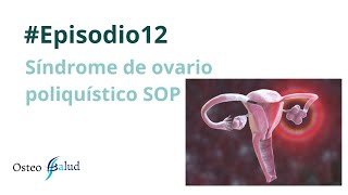 Episodio 12  Síndrome de ovario poliquístico SOP [upl. by Dao447]